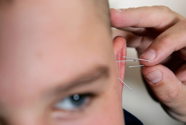 ©TSL. July 2004. Nine years ago this week Canon delivered my first EOS1D MkII. I shot for the first time with it on a job where staff were using acupuncture in a Sussex school to help boys with their behaviour.